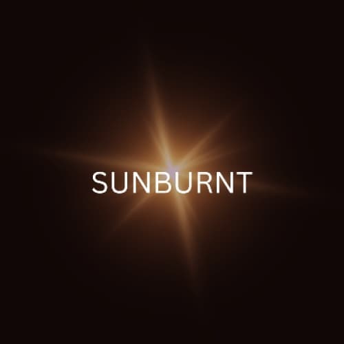 SUNBURNT